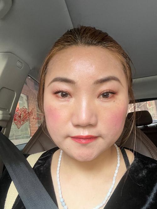 女性阴部流黄色液体是什么原因的相关介绍